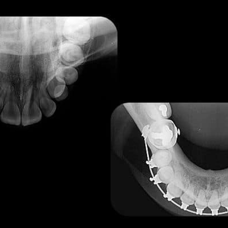 radiografia-oclusal