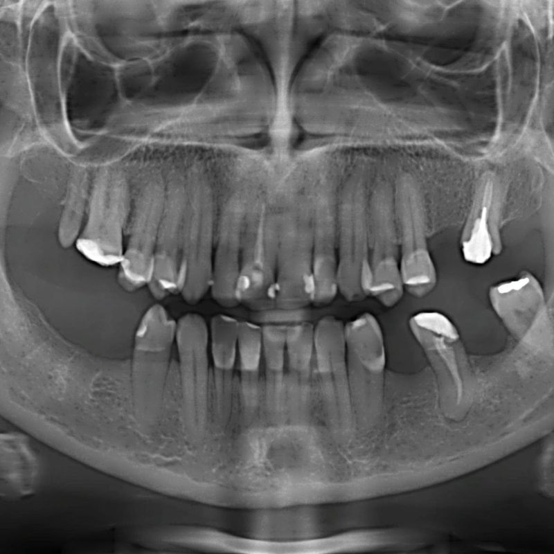 radiografia-panoramica